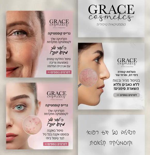 גריד פוסטים